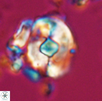 Zygodiscus selahattinkanlii 23090