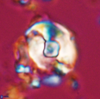 Zygodiscus selahattinkanlii 23091