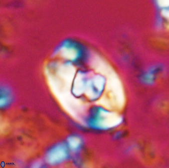 Zygodiscus selahattinkanlii 23107