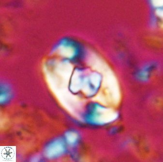 Zygodiscus selahattinkanlii 23107