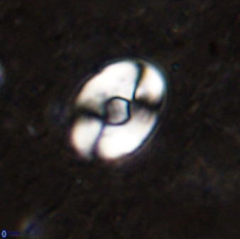 Zygodiscus sheldoniae 49712