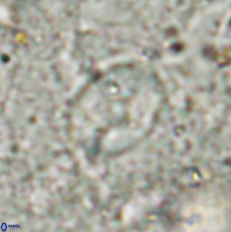 Zygodiscus sheldoniae 49713