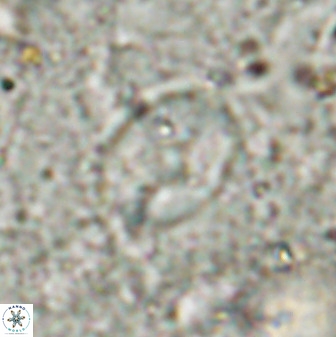 Zygodiscus sheldoniae 49713