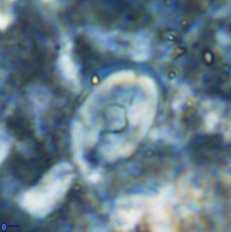 Zygodiscus sheldoniae 49714
