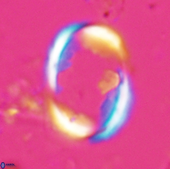 Zygodiscus skoteinigefyra 25113