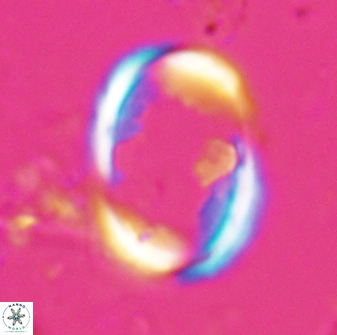 Zygodiscus skoteinigefyra 25113