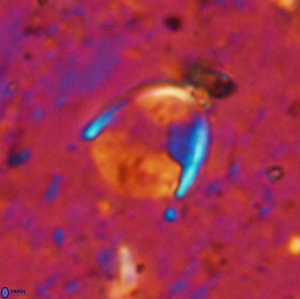 Zygodiscus skoteinigefyra 49847