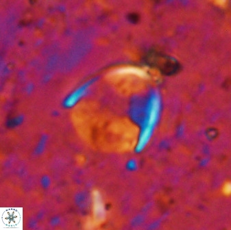 Zygodiscus skoteinigefyra 49847