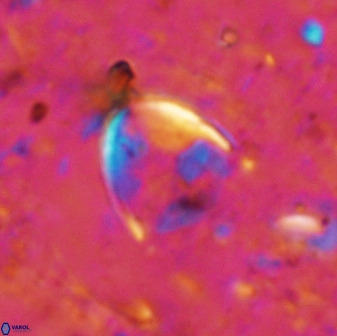 Zygodiscus skoteinigefyra 49851