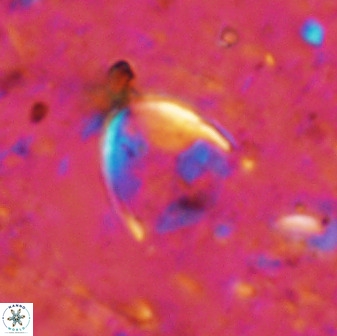 Zygodiscus skoteinigefyra 49851