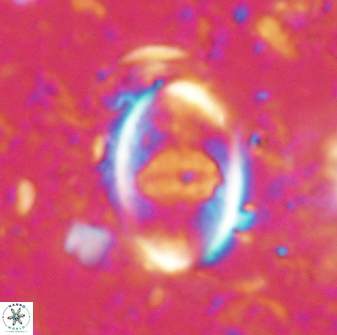 Zygodiscus skoteinigefyra 61031