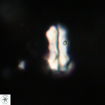 Zygrhablithus bijugatus VR 30656