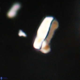 Zygrhablithus bijugatus VR 30659