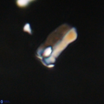 Zygrhablithus bijugatus VR 30660