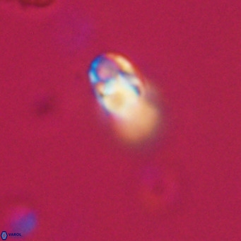 Zygrhablithus bijugatus VR 30673