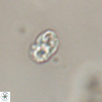 Zygrhablithus bijugatus VR 30837