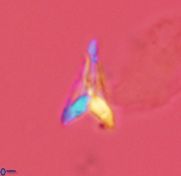 Ceratolithoides aculeus 3981