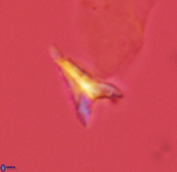 Ceratolithoides aculeus 3982