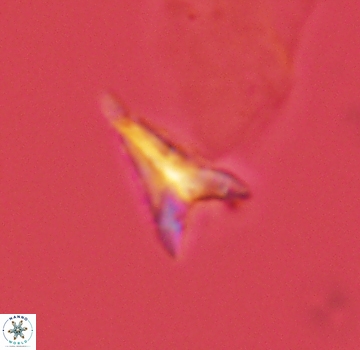 Ceratolithoides aculeus 3982