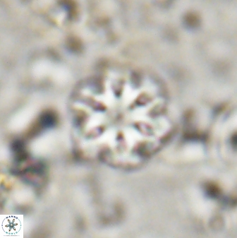 Oladiscoaster lepidus 30814