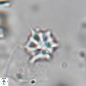 Olladiscoaster artatus 28400