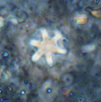 Olladiscoaster asterilithos 29586