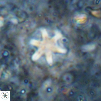Olladiscoaster asterilithos 29586