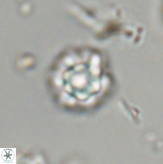 Olladiscoaster bordii 32615