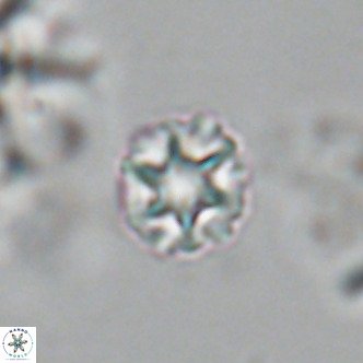 Olladiscoaster catinatus VR 18905