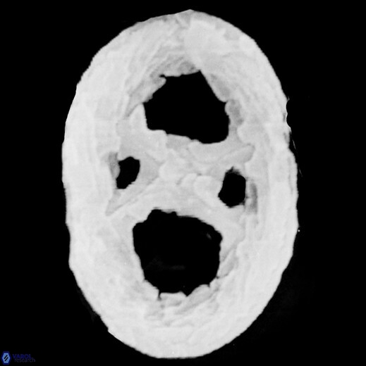 N rosenkrantzii default