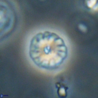 Calcidiscus pacificanus 63716