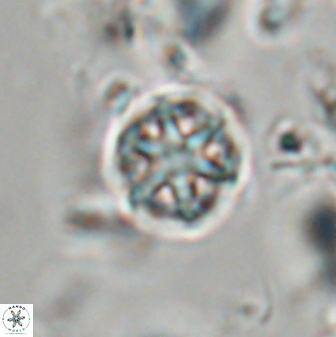 Catinaster coalitus 29261
