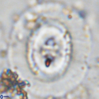 Coccolithus azorinus VR 10704