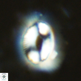 Coccolithus crassus VR 10763
