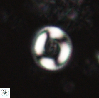 Denisea atalikii 60805