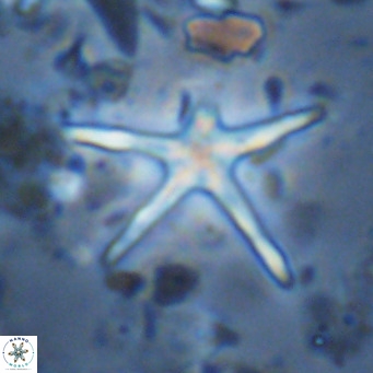 Discoaster asymmetricus VR 08205