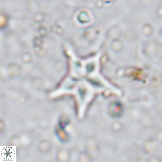 Discoaster asymmetroivrachiones VR 17836