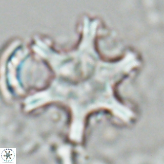 Discoaster fawzyi 26985