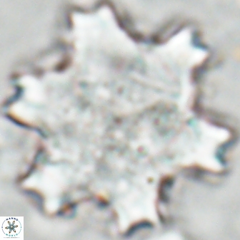 Discoaster soyhanii 27032