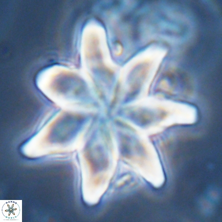 Discoaster nobilis 70528