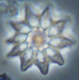 Discoaster splendidus 58251