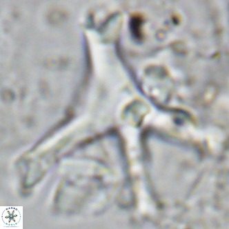 Discoaster surculus pullumpedes VR 08443