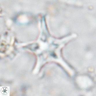 Discoaster bengalica VR 17622