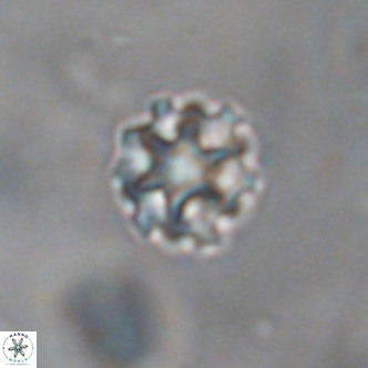 Discoaster puvillandii VR 18140