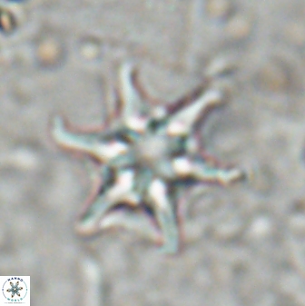 Discoaster vandekampiorum 27329