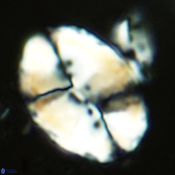 Pontosphaera lowei VR 07737