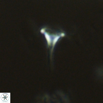 Discosphaera tubifera VR 04953