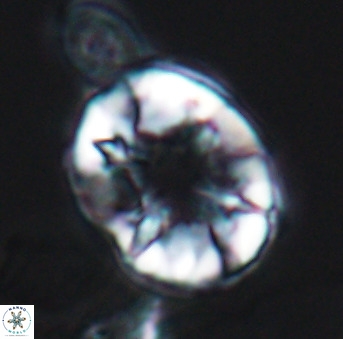 Eiffellithus trifurcatus 11736