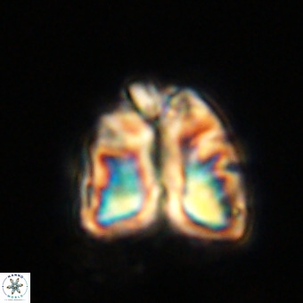 Fasciculithus bobbii VR 00044