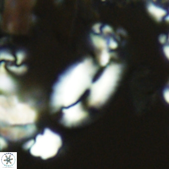 Helicosphaera epimikeisporous VR 05364